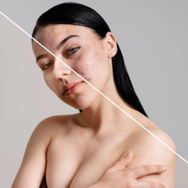 Conubia nostra per inceptos